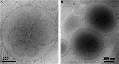 Phosphatidylserine-Liposomes Promote Tolerogenic Features on Dendritic Cells in Human Type 1 Diabetes by Apoptotic Mimicry